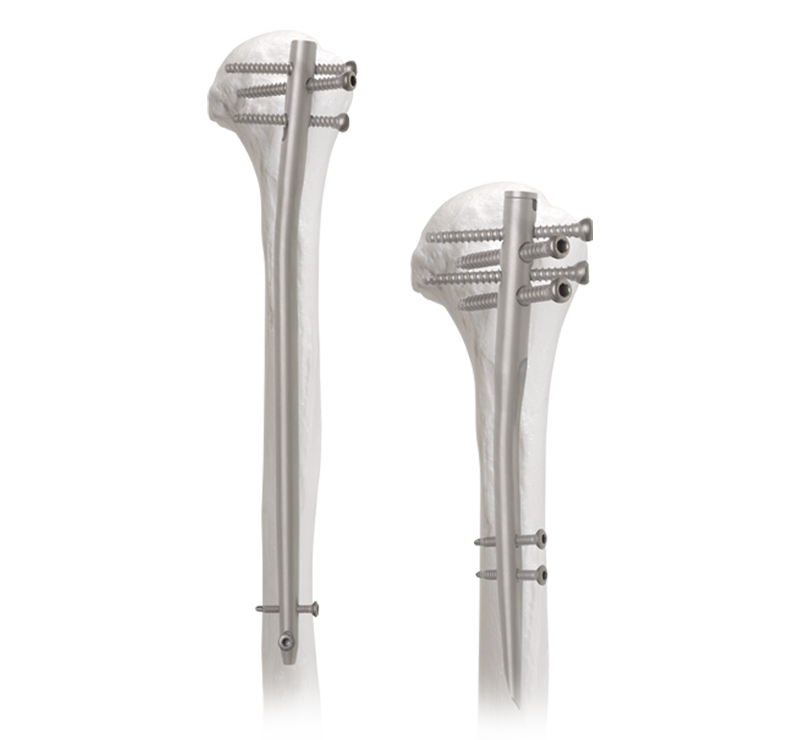SunMed Bougie Endotracheal Introducer with Coudé Tip - Adult